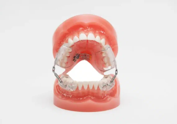 Hyperpropulseur, appareil orthodontique amovible