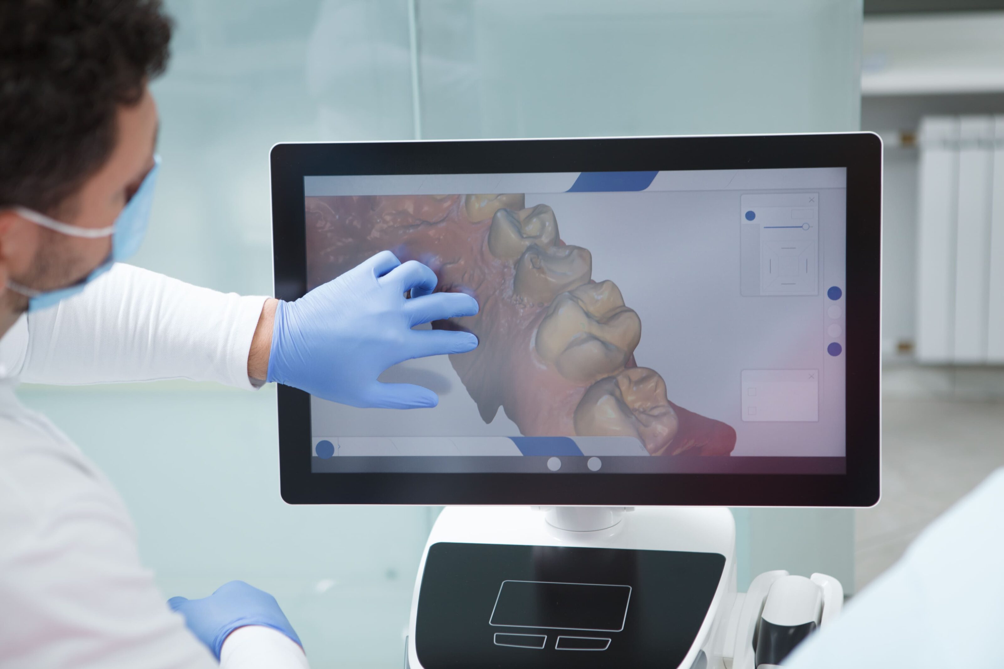 Modèle 3D des dents affiché sur un écran de planification
